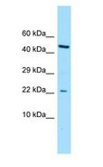 CGGBP1 Antibody - CGGBP1 antibody Western Blot of ACHN.  This image was taken for the unconjugated form of this product. Other forms have not been tested.