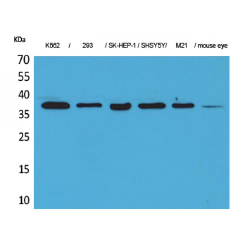 CGI-96 / RRP7A Antibody - Western blot of RRP7A antibody