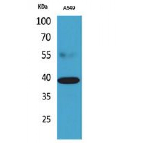 CGR19 / CGRRF1 Antibody - Western blot of CGR19 antibody