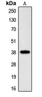 CGR19 / CGRRF1 Antibody - Western blot analysis of RNF197 expression in HeLa (A) whole cell lysates.
