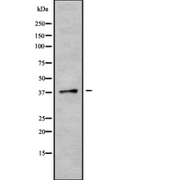 CGR19 / CGRRF1 Antibody - Western blot analysis of CGRRF1 using K562 whole cells lysates