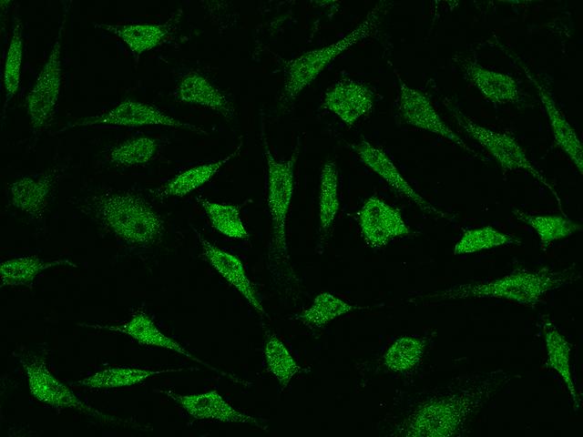 CGR19 / CGRRF1 Antibody - Immunofluorescence staining of CGRRF1 in HeLa cells. Cells were fixed with 4% PFA, permeabilzed with 0.1% Triton X-100 in PBS, blocked with 10% serum, and incubated with rabbit anti-human CGRRF1 polyclonal antibody (dilution ratio 1:1000) at 4°C overnight. Then cells were stained with the Alexa Fluor 488-conjugated Goat Anti-rabbit IgG secondary antibody (green). Positive staining was localized to nucleus and cytoplasm.