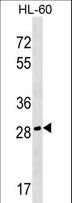 CGREF1 Antibody - CGREF1 Antibody western blot of HL-60 cell line lysates (35 ug/lane). The CGREF1 antibody detected the CGREF1 protein (arrow).