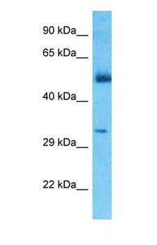 CGREF1 Antibody - Western blot of CGREF1 Antibody with Thymus Tumor lysate.  This image was taken for the unconjugated form of this product. Other forms have not been tested.
