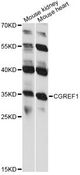 CGREF1 Antibody - Western blot analysis of extracts of various cell lines, using CGREF1 antibody at 1:1000 dilution. The secondary antibody used was an HRP Goat Anti-Rabbit IgG (H+L) at 1:10000 dilution. Lysates were loaded 25ug per lane and 3% nonfat dry milk in TBST was used for blocking. An ECL Kit was used for detection and the exposure time was 90s.