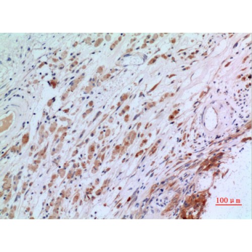 CGREF1 Antibody - Immunohistochemistry of CGREF1 antibody