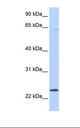 CHAC1 / MGC4504 Antibody - 721_B cell lysate. Antibody concentration: 1.0 ug/ml. Gel concentration: 12%.  This image was taken for the unconjugated form of this product. Other forms have not been tested.