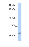 CHAC1 / MGC4504 Antibody - 721_B cell lysate. Antibody concentration: 1.0 ug/ml. Gel concentration: 12%.  This image was taken for the unconjugated form of this product. Other forms have not been tested.