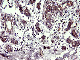 CHAC1 / MGC4504 Antibody - IHC of paraffin-embedded Human breast tissue using anti-CHAC1 mouse monoclonal antibody. (Heat-induced epitope retrieval by 10mM citric buffer, pH6.0, 120°C for 3min).