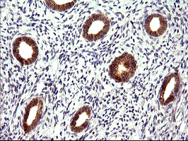 CHAC1 / MGC4504 Antibody - IHC of paraffin-embedded Human endometrium tissue using anti-CHAC1 mouse monoclonal antibody. (Heat-induced epitope retrieval by 10mM citric buffer, pH6.0, 120°C for 3min).