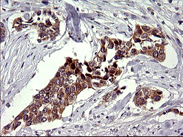 CHAC1 / MGC4504 Antibody - IHC of paraffin-embedded Human bladder tissue using anti-CHAC1 mouse monoclonal antibody. (Heat-induced epitope retrieval by 10mM citric buffer, pH6.0, 120°C for 3min).