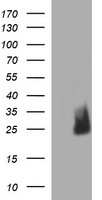 CHAC1 / MGC4504 Antibody - HEK293T cells were transfected with the pCMV6-ENTRY control (Left lane) or pCMV6-ENTRY CHAC1 (Right lane) cDNA for 48 hrs and lysed. Equivalent amounts of cell lysates (5 ug per lane) were separated by SDS-PAGE and immunoblotted with anti-CHAC1.