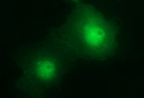 CHAC1 / MGC4504 Antibody - Anti-CHAC1 mouse monoclonal antibody immunofluorescent staining of COS7 cells transiently transfected by pCMV6-ENTRY CHAC1.