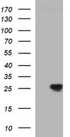 CHAC1 / MGC4504 Antibody - HEK293T cells were transfected with the pCMV6-ENTRY control (Left lane) or pCMV6-ENTRY CHAC1 (Right lane) cDNA for 48 hrs and lysed. Equivalent amounts of cell lysates (5 ug per lane) were separated by SDS-PAGE and immunoblotted with anti-CHAC1.