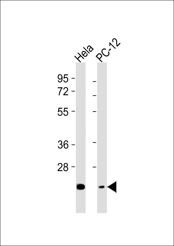CHAC1 / MGC4504 Antibody - All lanes : Anti-CHAC1 Antibody at 1:1000 dilution Lane 1: HeLa whole cell lysates Lane 2: PC-12 whole cell lysates Lysates/proteins at 20 ug per lane. Secondary Goat Anti-Rabbit IgG, (H+L),Peroxidase conjugated at 1/10000 dilution Predicted band size : 29 kDa Blocking/Dilution buffer: 5% NFDM/TBST.