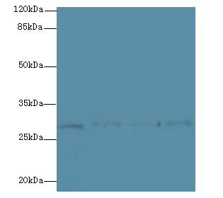 CHAC1 / MGC4504 Antibody - Western blot. All lanes: CHAC1 antibody at 8 ug/ml. Lane 1: HeLa whole cell lysate. Lane 2: PC-3 whole cell lysate. Lane 3: MCF7 whole cell lysate. Lane 4: Mouse Skeletal muscle tissue. Secondary Goat polyclonal to Rabbit IgG at 1:10000 dilution. Predicted band size: 29 kDa. Observed band size: 29 kDa.