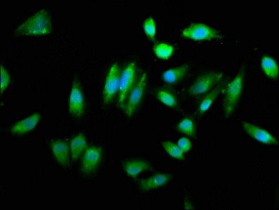 CHAC1 / MGC4504 Antibody - Immunofluorescence staining of Hela cells with CHAC1 Antibody at 1:260, counter-stained with DAPI. The cells were fixed in 4% formaldehyde, permeabilized using 0.2% Triton X-100 and blocked in 10% normal Goat Serum. The cells were then incubated with the antibody overnight at 4°C. The secondary antibody was Alexa Fluor 488-congugated AffiniPure Goat Anti-Rabbit IgG(H+L).