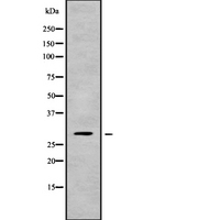 CHAC1 / MGC4504 Antibody - Western blot analysis of CHAC1 using Jurkat whole cells lysates
