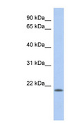 CHAC2 Antibody - CHAC2 antibody Western blot of Placenta lysate. This image was taken for the unconjugated form of this product. Other forms have not been tested.