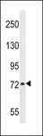 CHADL Antibody - CHADL Antibody western blot of T47D cell line lysates (35 ug/lane). The CHADL antibody detected the CHADL protein (arrow).