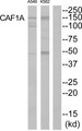 CHAF1A / CAF1 Antibody - Western blot of extracts from K562 cells and A549 cells, using CAF1A antibody.