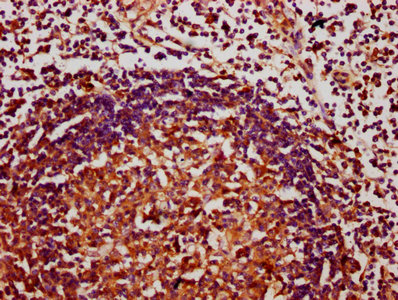 CHAF1A / CAF1 Antibody - Immunohistochemistry Dilution at 1:400 and staining in paraffin-embedded human lymph node tissue performed on a Leica BondTM system. After dewaxing and hydration, antigen retrieval was mediated by high pressure in a citrate buffer (pH 6.0). Section was blocked with 10% normal Goat serum 30min at RT. Then primary antibody (1% BSA) was incubated at 4°C overnight. The primary is detected by a biotinylated Secondary antibody and visualized using an HRP conjugated SP system.
