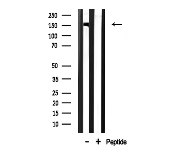 CHAF1A / CAF1 Antibody - Western blot analysis of CAF1A expression in rat brain lysate