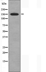 CHAF1A / CAF1 Antibody - Western blot analysis of extracts of K562 cells using CAF1A antibody.