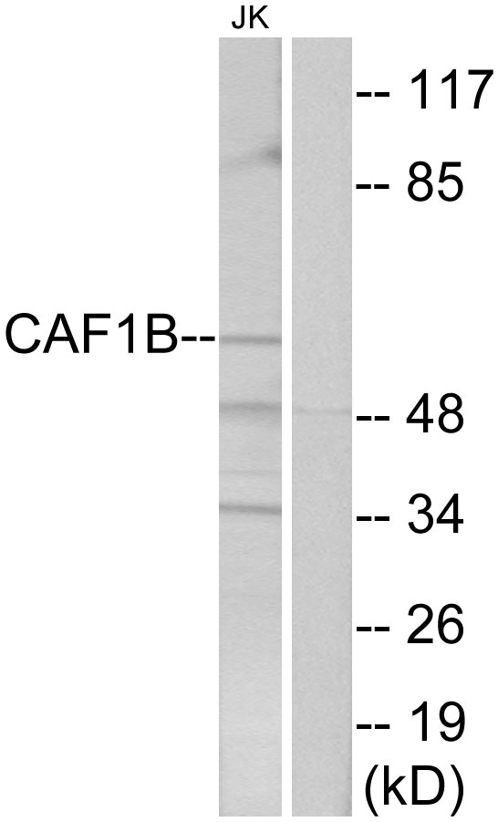 CHAF1B / CAF1 Antibody - Western blot analysis of lysates from Jurkat cells, using CAF1B Antibody. The lane on the right is blocked with the synthesized peptide.