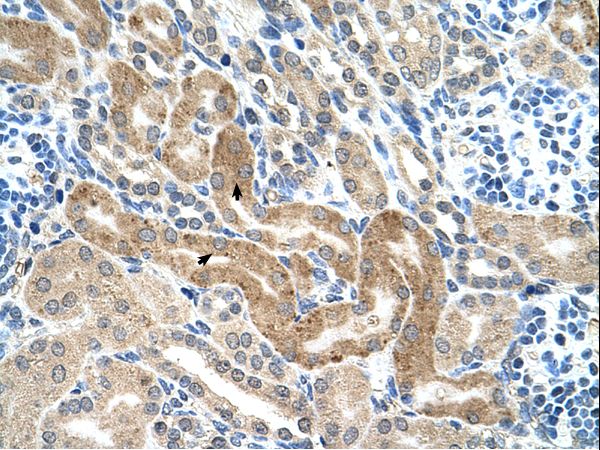 CHAF1B / CAF1 Antibody - CHAF1B antibody CHAF1B(chromatin assembly factor 1, subunit B (p60)) Antibody was used in IHC to stain formalin-fixed, paraffin-embedded human kidney.  This image was taken for the unconjugated form of this product. Other forms have not been tested.