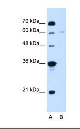 CHAF1B / CAF1 Antibody - Lane A: Marker. Lane B: Jurkat cell lysate. Antibody concentration: 5.0 ug/ml. Gel concentration: 12%.  This image was taken for the unconjugated form of this product. Other forms have not been tested.