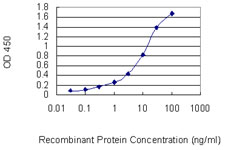 CHAF1B / CAF1 Antibody - Detection limit for recombinant GST tagged CHAF1B is 0.1 ng/ml as a capture antibody.