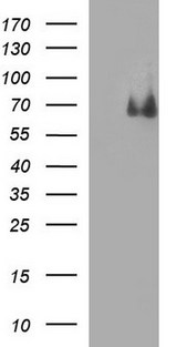 CHAF1B / CAF1 Antibody - HEK293T cells were transfected with the pCMV6-ENTRY control (Left lane) or pCMV6-ENTRY CHAF1B (Right lane) cDNA for 48 hrs and lysed. Equivalent amounts of cell lysates (5 ug per lane) were separated by SDS-PAGE and immunoblotted with anti-CHAF1B.