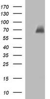 CHAF1B / CAF1 Antibody - HEK293T cells were transfected with the pCMV6-ENTRY control (Left lane) or pCMV6-ENTRY CHAF1B (Right lane) cDNA for 48 hrs and lysed. Equivalent amounts of cell lysates (5 ug per lane) were separated by SDS-PAGE and immunoblotted with anti-CHAF1B.
