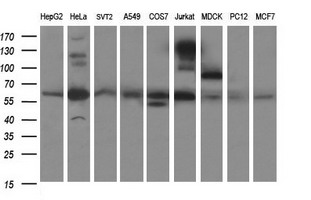CHAF1B / CAF1 Antibody - Western blot of extracts (35ug) from 9 different cell lines by using anti-CHAF1B monoclonal antibody (HepG2: human; HeLa: human; SVT2: mouse; A549: human; COS7: monkey; Jurkat: human; MDCK: canine; PC12: rat; MCF7: human).