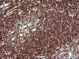 CHAF1B / CAF1 Antibody - IHC of paraffin-embedded Human lymph node tissue using anti-CHAF1B mouse monoclonal antibody. (Heat-induced epitope retrieval by 10mM citric buffer, pH6.0, 120°C for 3min).