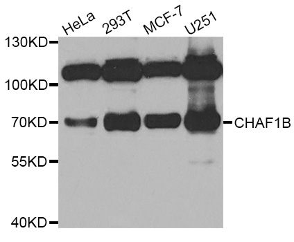 CHAF1B / CAF1 Antibody - Western blot analysis of extracts of various cell lines.