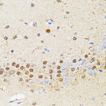 CHAF1B / CAF1 Antibody - Immunohistochemistry of paraffin-embedded rat brain tissue.