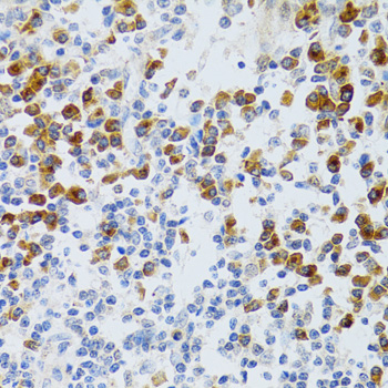 CHAF1B / CAF1 Antibody - Immunohistochemistry of paraffin-embedded human tonsil tissue.