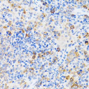 CHAF1B / CAF1 Antibody - Immunohistochemistry of paraffin-embedded mouse spleen tissue.