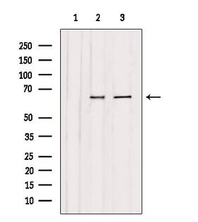 CHAF1B / CAF1 Antibody - Western blot analysis of extracts of various samples using CAF1B antibody. Lane 1: mouse carcinoma treated with blocking peptide. Lane 2: mouse carcinoma; Lane 3: mouse brain;