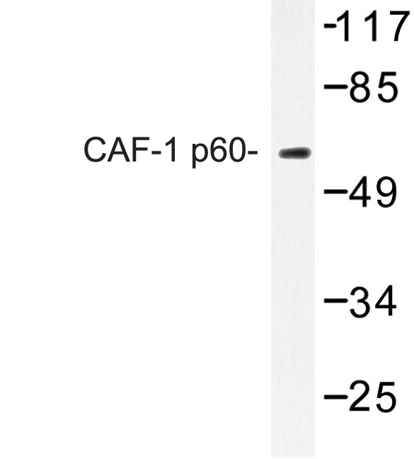 CHAF1B / CAF1 Antibody - Western blot of CAF-1 p60 (W93) pAb in extracts from Jurkat cells.