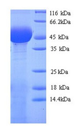 PLY1 / Pectate lyase 1 Protein