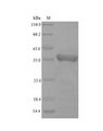 VP3 / Apoptin Protein - (Tris-Glycine gel) Discontinuous SDS-PAGE (reduced) with 5% enrichment gel and 15% separation gel.