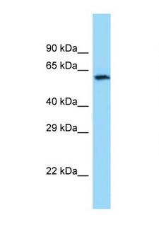 CHAT Antibody - CHAT antibody Western blot of Fetal Brain lysate. Antibody concentration 1 ug/ml.  This image was taken for the unconjugated form of this product. Other forms have not been tested.