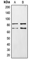 CHAT Antibody - Western blot analysis of CHAT expression in IMR32 (A); SKNSH (B) whole cell lysates.
