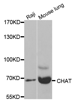 CHAT Antibody - Western blot analysis of extracts of various cell lines, using CHAT antibody.