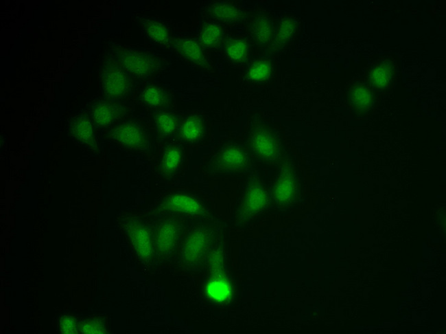 CHAT Antibody - Immunofluorescence analysis of MCF-7 cell using CHAT antibody.