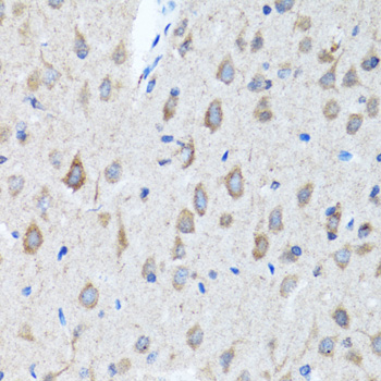 CHAT Antibody - Immunohistochemistry of paraffin-embedded rat brain tissue.