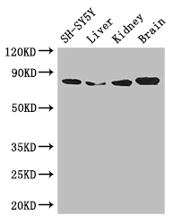 CHAT Antibody - Positive WB detected in:SH-SY5Y whole cell lysate,Mouse liver tissue,Mouse kidney tissue,Mouse brain tissue;All lanes: CHAT antibody at 3ug/ml;Secondary;Goat polyclonal to rabbit IgG at 1/50000 dilution;Predicted band size: 83,75,71 kDa;Observed band size: 83 kDa;